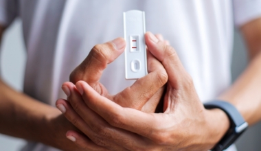 test kiirtest hiv ülemiste keskus kliinik